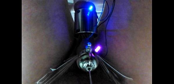  Bound and electro stimmed